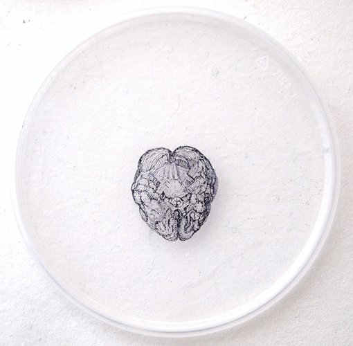 daisuke_suzuki_P-15_ Human Brain_details_details.jpg(213350 byte)